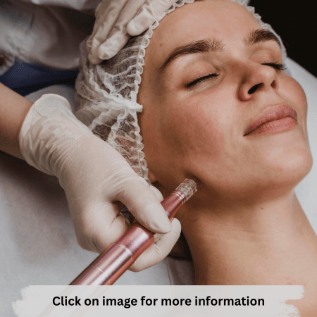 MICRONEEDLING COURSE